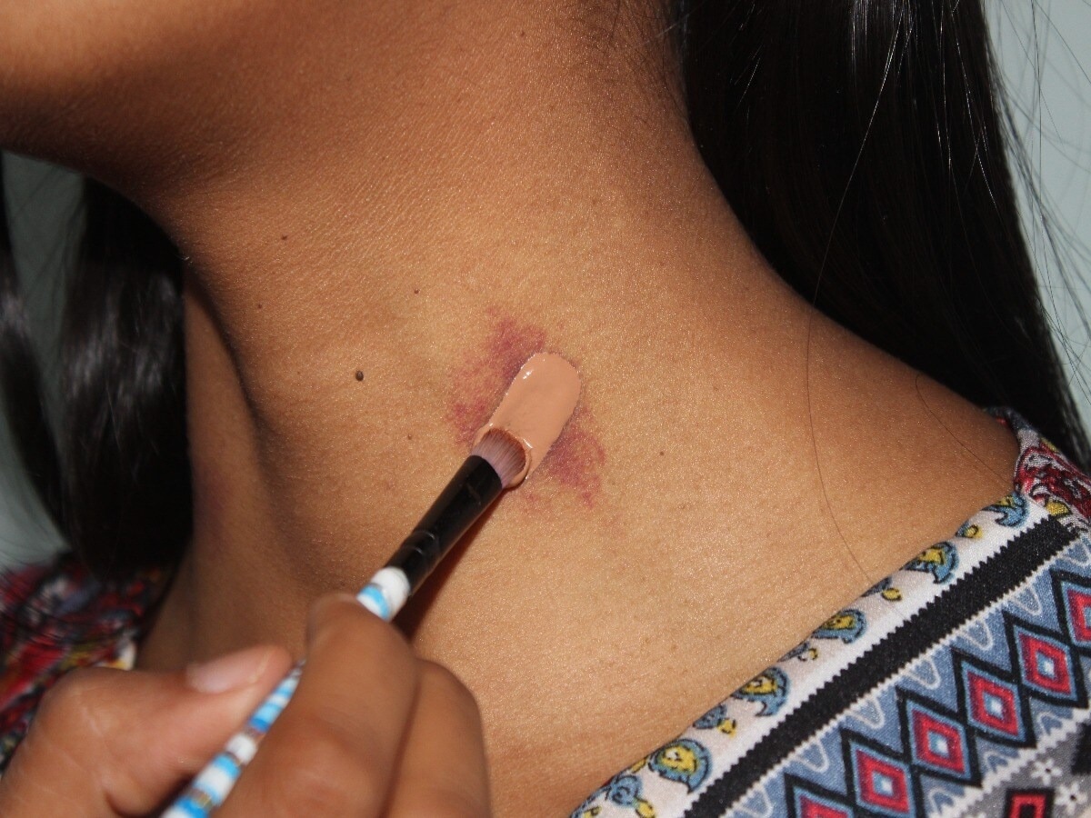 Love Bite 1727170675877 1727170687390 Satya Day